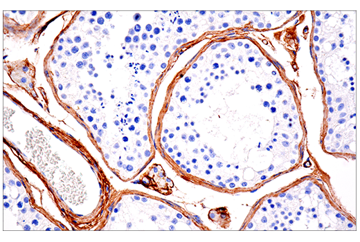 Immunohistochemistry Image 2: COL1A1 (E3E1X) Mouse Monoclonal Antibody