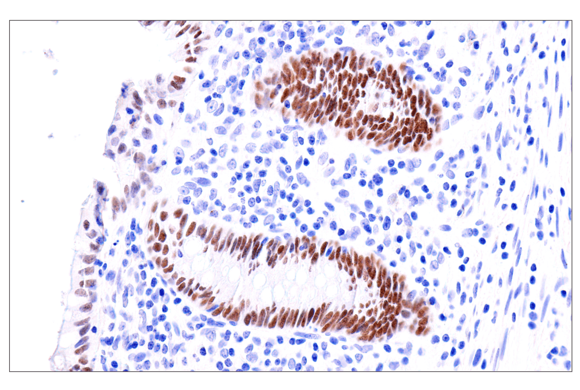 Immunohistochemistry Image 14: GATA-6 (D61E4) Rabbit Monoclonal Antibody