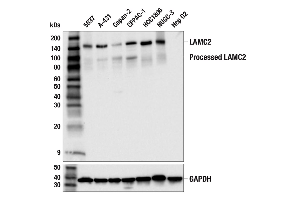 Western Blotting Image 1: LAMC2 (E9F7M) Rabbit mAb