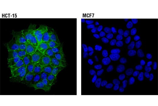 Immunofluorescence Image 1: MDR1/ABCB1 (E1Y7B) Rabbit Monoclonal Antibody