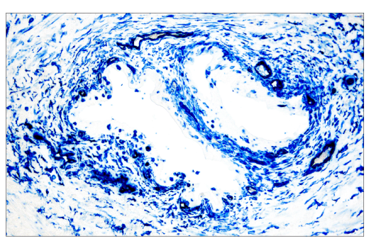 Immunohistochemistry Image 1: SignalStain<sup>®</sup> Ultra Blue Alkaline Phosphatase Substrate Kit