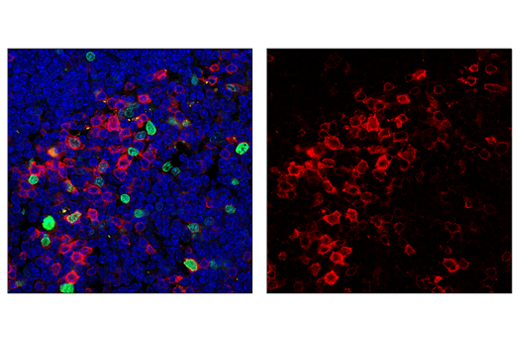 Immunofluorescence Image 1: PD-1 (Intracellular Domain) (D7D5W) XP<sup>®</sup> Rabbit mAb (Alexa Fluor<sup>®</sup> 647 Conjugate)
