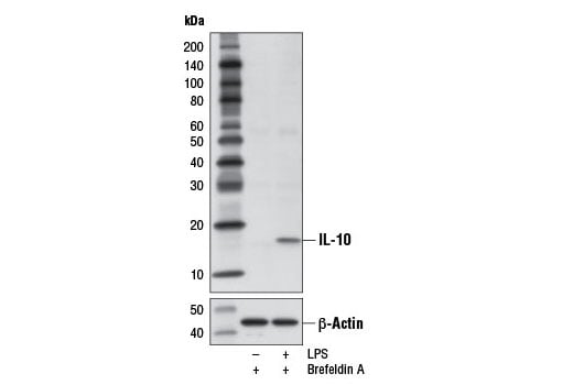 Western Blotting Image 2: IL-10 (D13A11) Rabbit Monoclonal Antibody