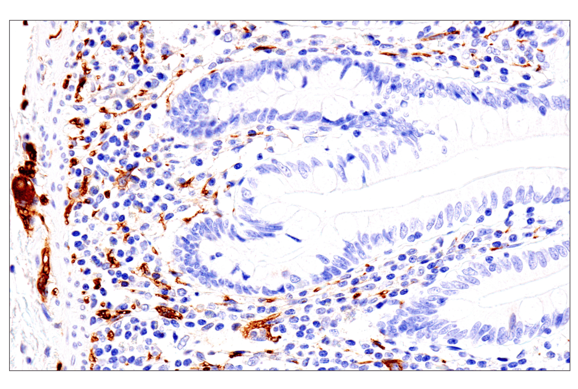Immunohistochemistry Image 8: p75NTR (E7I3M) Rabbit Monoclonal Antibody (BSA and Azide Free)