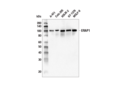 Western Blotting Image 1: ERAP1 (E6X1P) Rabbit mAb