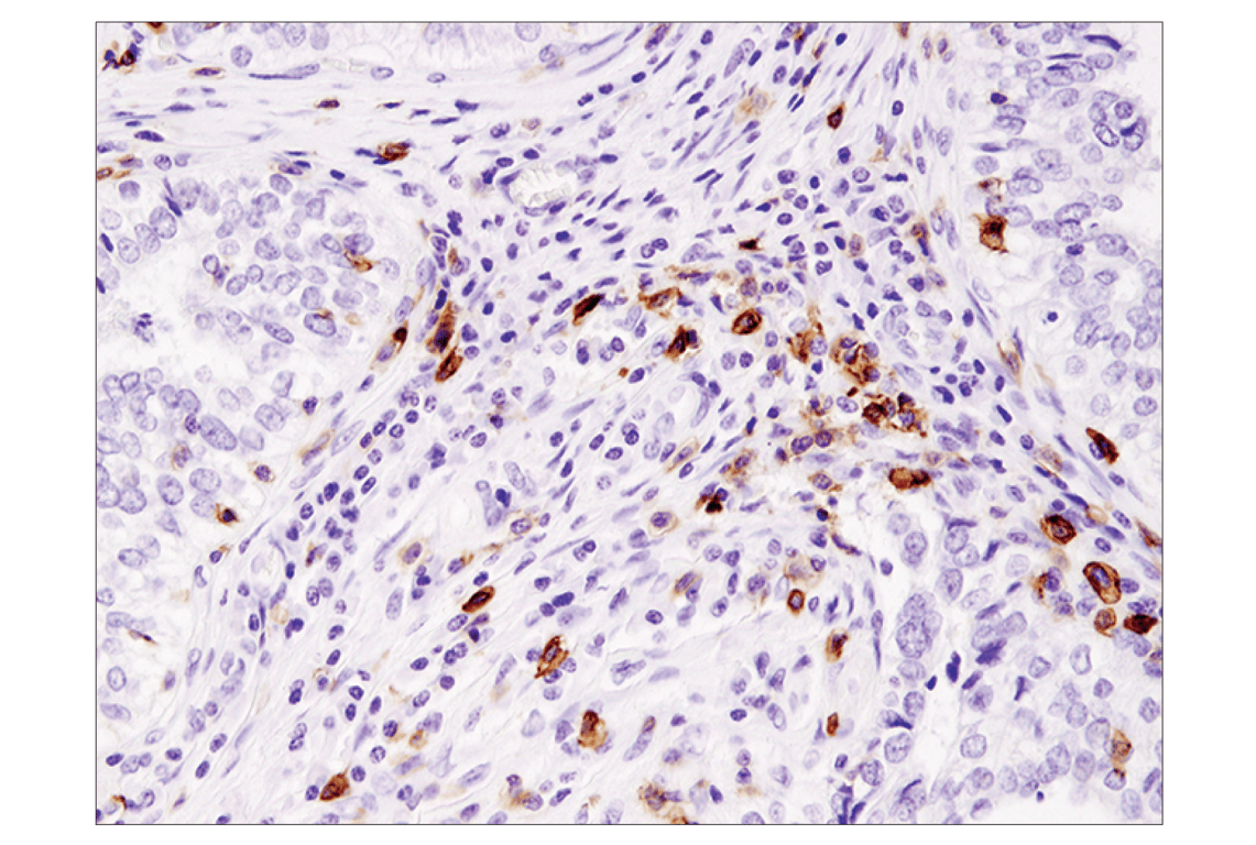Immunohistochemistry Image 2: ICOS (D1K2T) Rabbit Monoclonal Antibody (BSA and Azide Free)