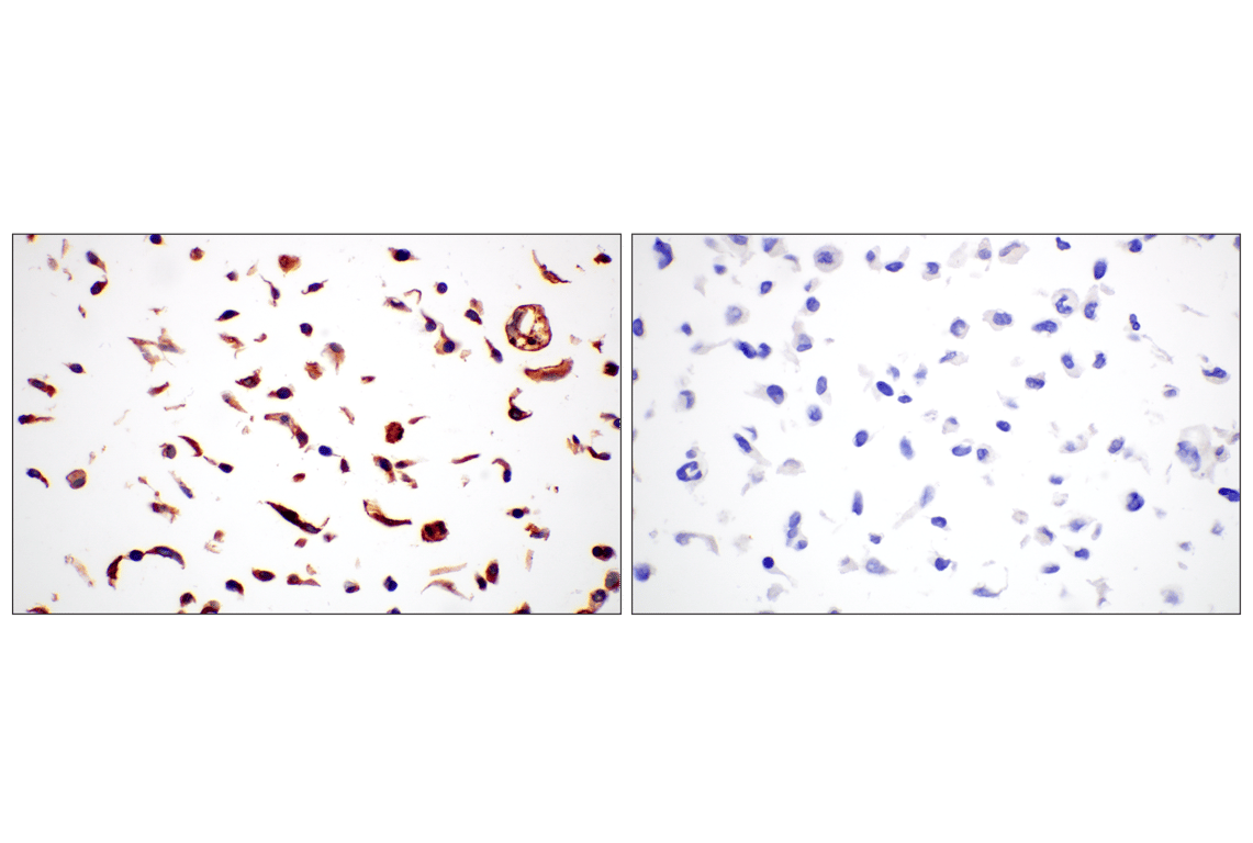 Immunohistochemistry Image 7: Folate Receptor Alpha/FOLR1 (E8U2F) Mouse Monoclonal Antibody (BSA and Azide Free)