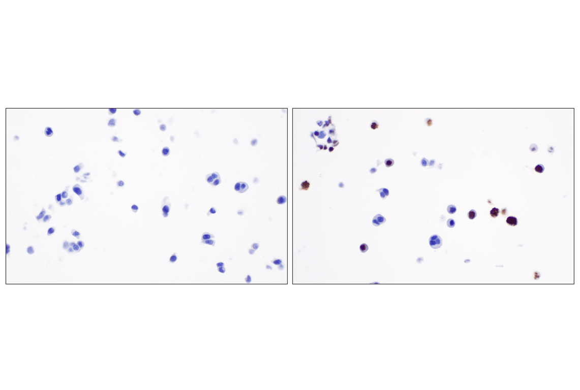 Immunohistochemistry Image 13: Phospho-Histone H3 (Ser10) (D7N8E) Rabbit Monoclonal Antibody