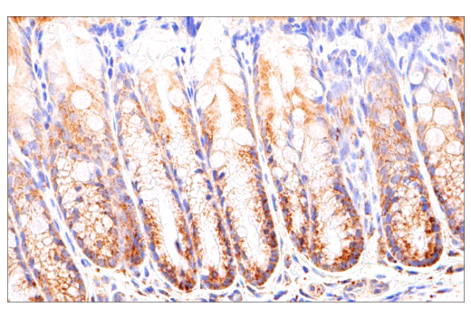 Immunohistochemistry Image 9: SDHB (E3H9Z) Rabbit Monoclonal Antibody