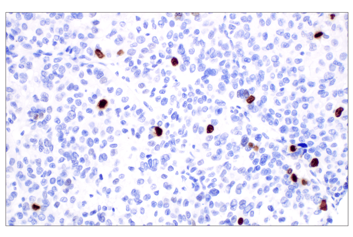 Immunohistochemistry Image 10: Phospho-Histone H3 (Ser10) (D7N8E) Rabbit Monoclonal Antibody