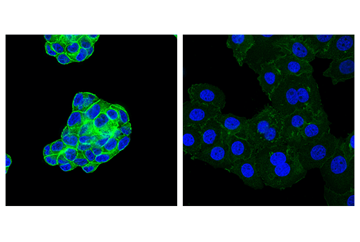 Immunofluorescence Image 1: Ras (E4K9L) Rabbit mAb (Alexa Fluor<sup>®</sup> 488 Conjugate)