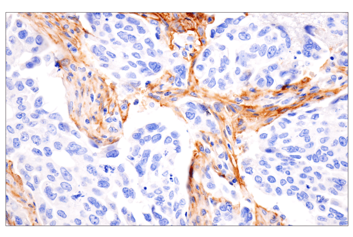 Immunohistochemistry Image 5: LRRC15 (E4X8J) Rabbit Monoclonal Antibody