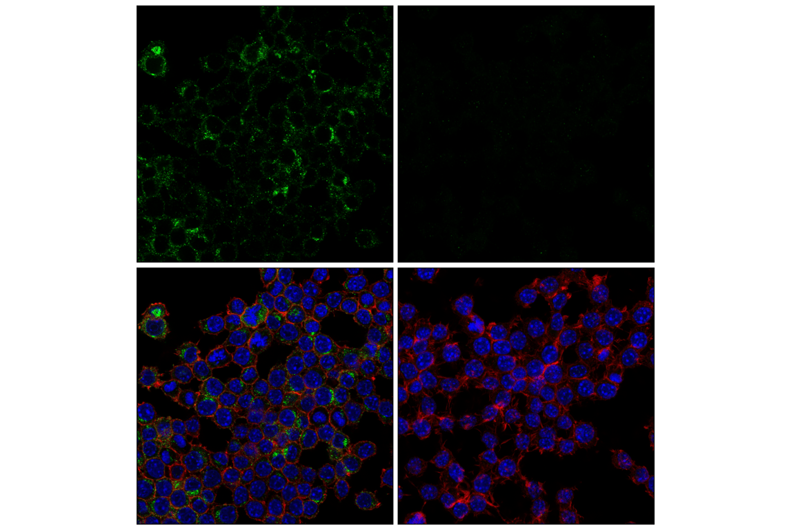 Immunofluorescence Image 1: TREM2 (E7O7Q) Rabbit Monoclonal Antibody