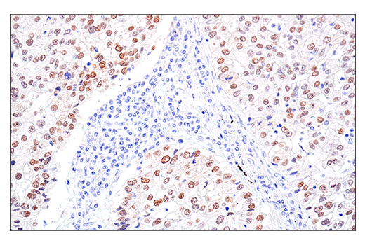 Immunohistochemistry Image 5: MAGE-A10 (E9V2Q) Rabbit Monoclonal Antibody