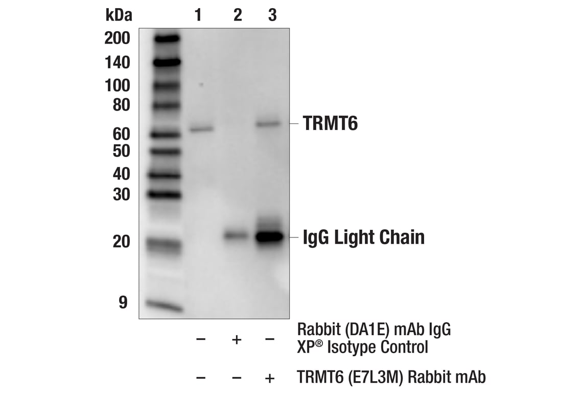 Immunoprecipitation Image 1: TRMT6 (E7L3M) Rabbit Monoclonal Antibody