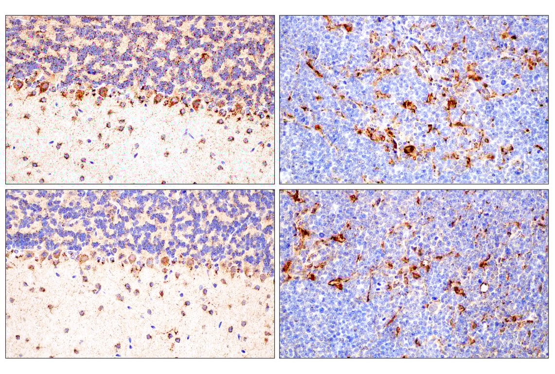undefined Image 46: Genetics of Parkinson's Disease: Lysosomal Dysfunction Antibody Sampler Kit