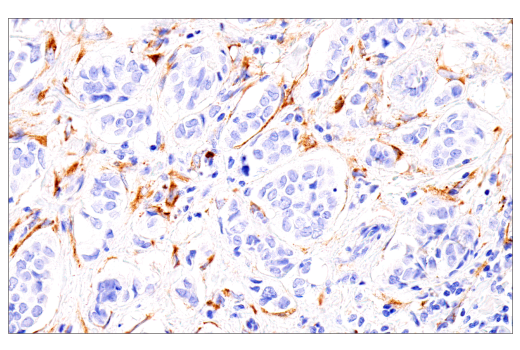 Immunohistochemistry Image 2: COL5A1 (E6U9W) Rabbit Monoclonal Antibody (BSA and Azide Free)