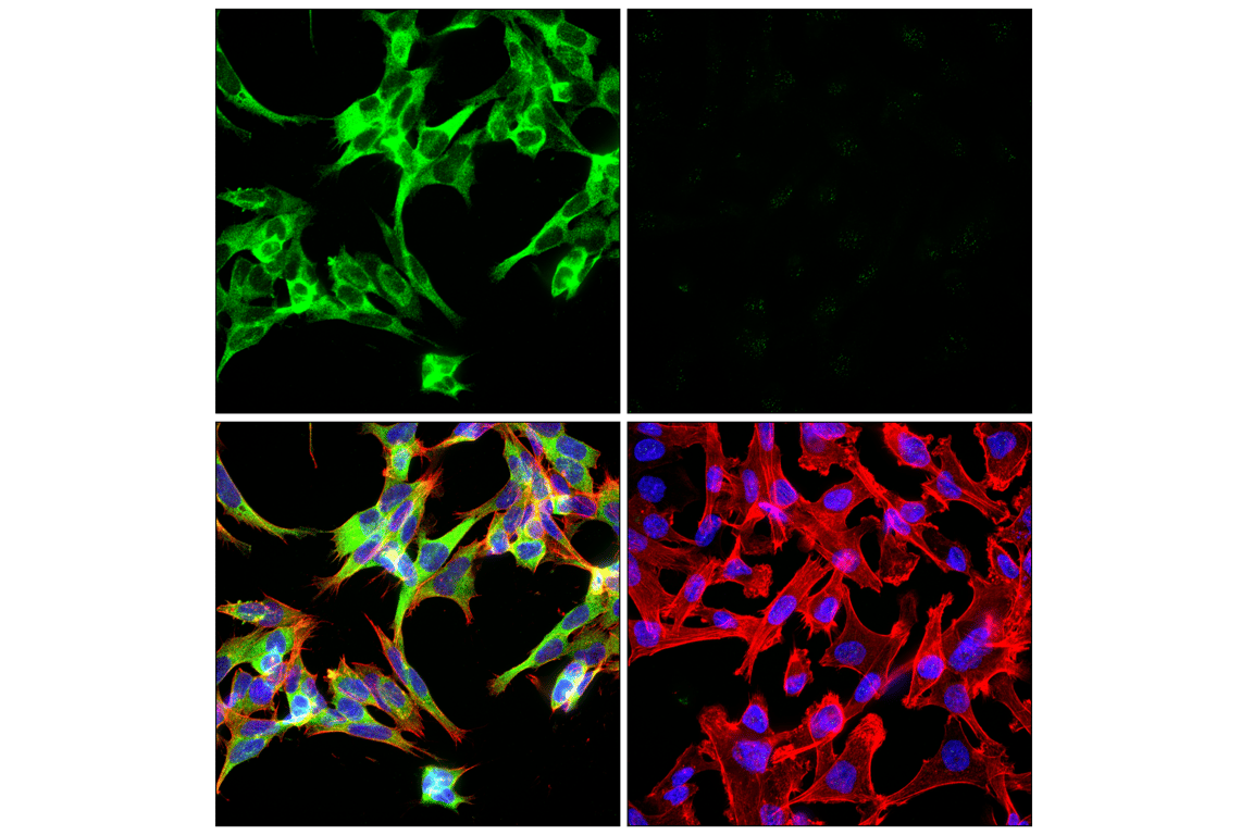 Immunofluorescence Image 1: Phospho-Tau (Ser202) (F2A2F) Rabbit Monoclonal Antibody