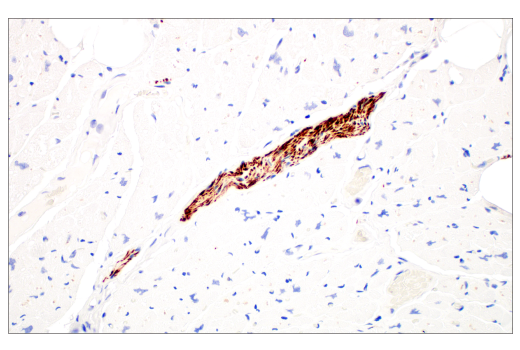 Immunohistochemistry Image 5: Neurofilament-M (E7Y8W) Mouse Monoclonal Antibody (BSA and Azide Free)