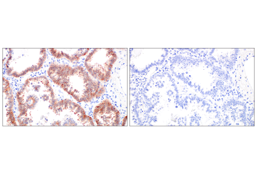 Immunohistochemistry Image 7: Integrin beta6 (E4M9P) Rabbit Monoclonal Antibody