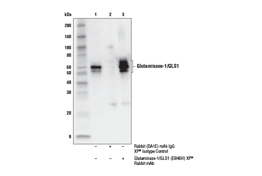 undefined Image 12: Glutamine Metabolism Antibody Sampler Kit
