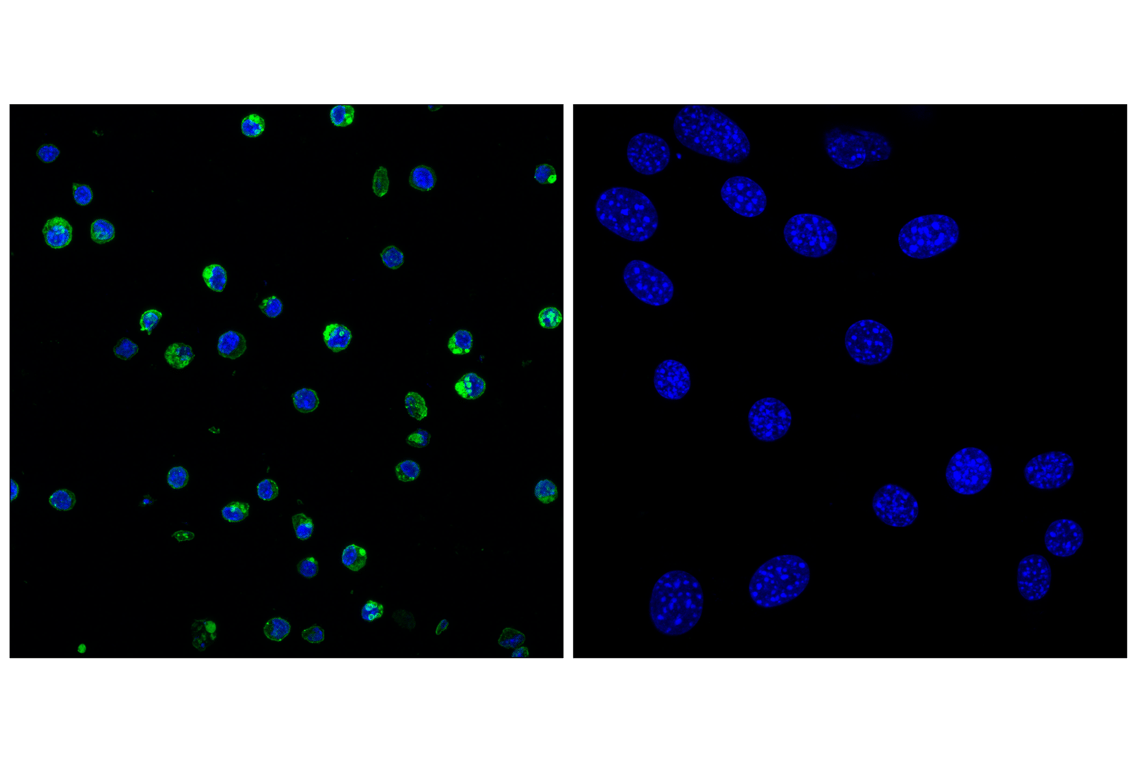 CD31 (PECAM-1) (F2N3M) Rabbit mAb | Cell Signaling Technology