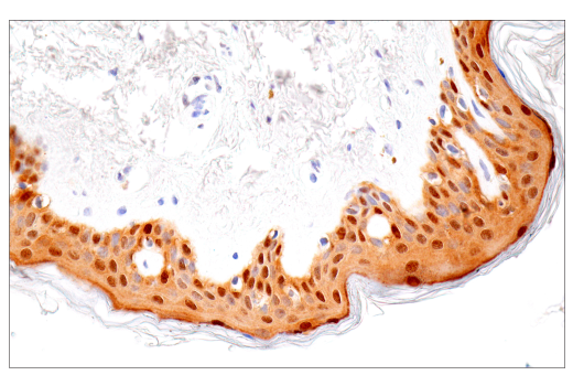 Immunohistochemistry Image 9: IL-18 (E3G8R) Rabbit Monoclonal Antibody (BSA and Azide Free)
