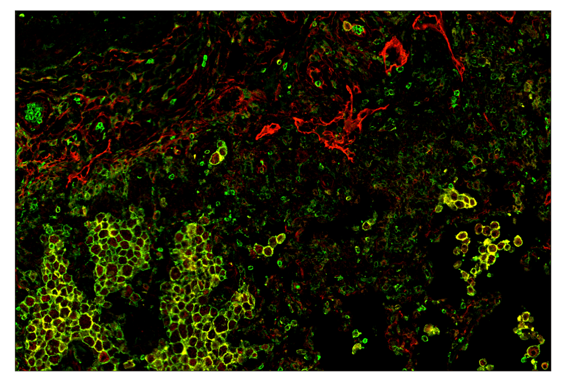 Immunohistochemistry Image 1: CD11b/ITGAM (D6X1N) & CO-0037-488 SignalStar<sup>™</sup> Oligo-Antibody Pair