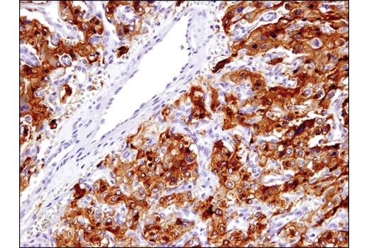 undefined Image 12: Lung Cancer RTK Antibody Sampler Kit