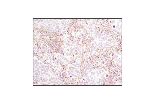 Immunohistochemistry Image 1: PDGF Receptor beta (C82A3) Rabbit Monoclonal Antibody