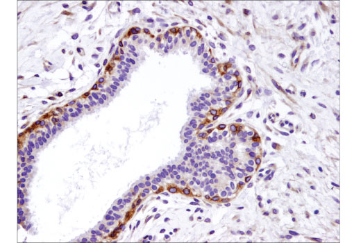 Immunohistochemistry Image 1: Integrin beta1 (D6S1W) Rabbit Monoclonal Antibody