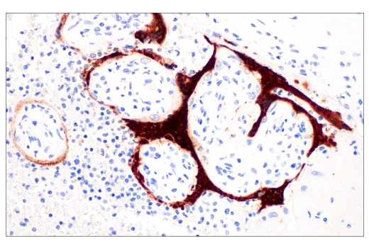 Immunohistochemistry Image 1: SARS-CoV-2 Nucleocapsid Protein (E9L7H) Rabbit Monoclonal Antibody