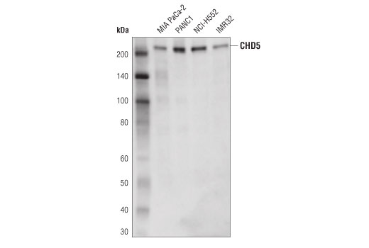 Western Blotting Image 1: CHD5 (D2F9Q) Rabbit mAb