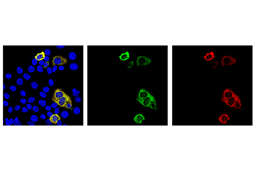 Immunofluorescence Image 1: Cas9 (<i>S. aureus</i>) (6H4) Mouse Monoclonal Antibody