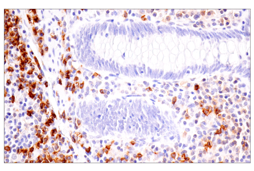 Immunohistochemistry Image 5: TNFRSF13C/BAFF-R (E3C1Q) Rabbit Monoclonal Antibody