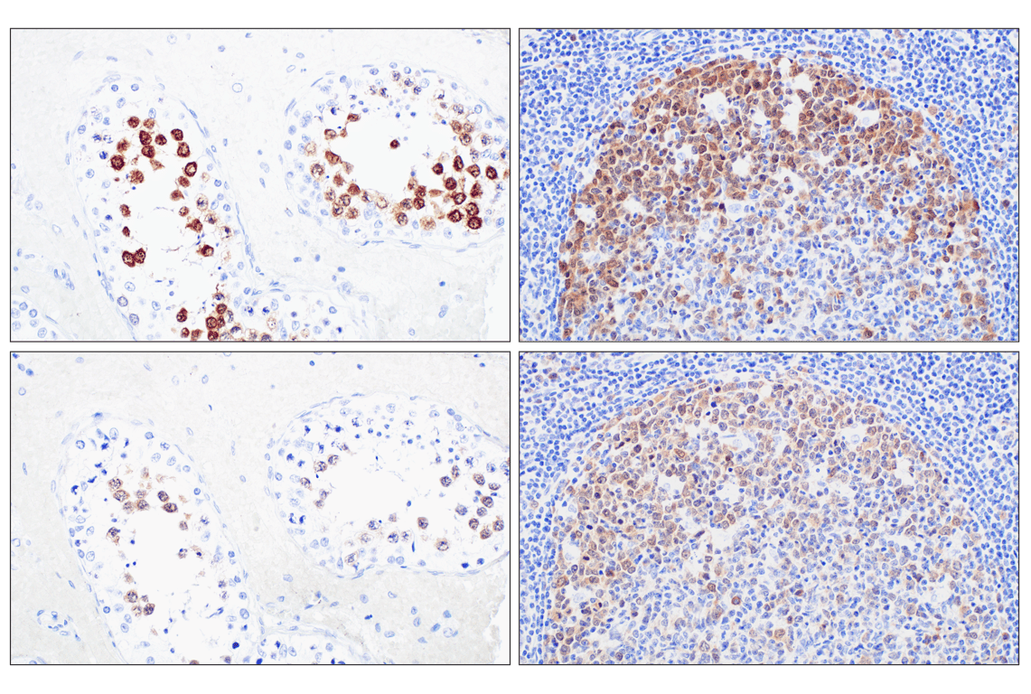 Immunohistochemistry Image 10: PBK/TOPK (F2X2Z) Rabbit Monoclonal Antibody