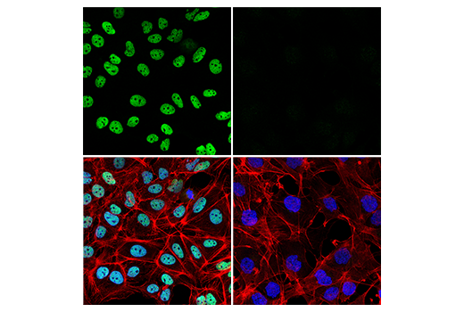 Immunofluorescence Image 1: PROX1 (D2J6J) Rabbit mAb