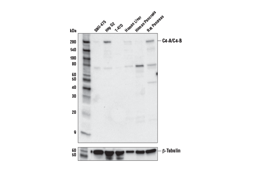 Western Blotting Image 1: Complement C4-A/C4-B (E6J7W) Rabbit mAb