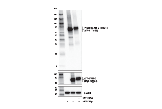 Western Blotting Image 2: Phospho-ATF-2 (Thr71)/ATF-7 (Thr53) (E4A5G) Rabbit Monoclonal Antibody