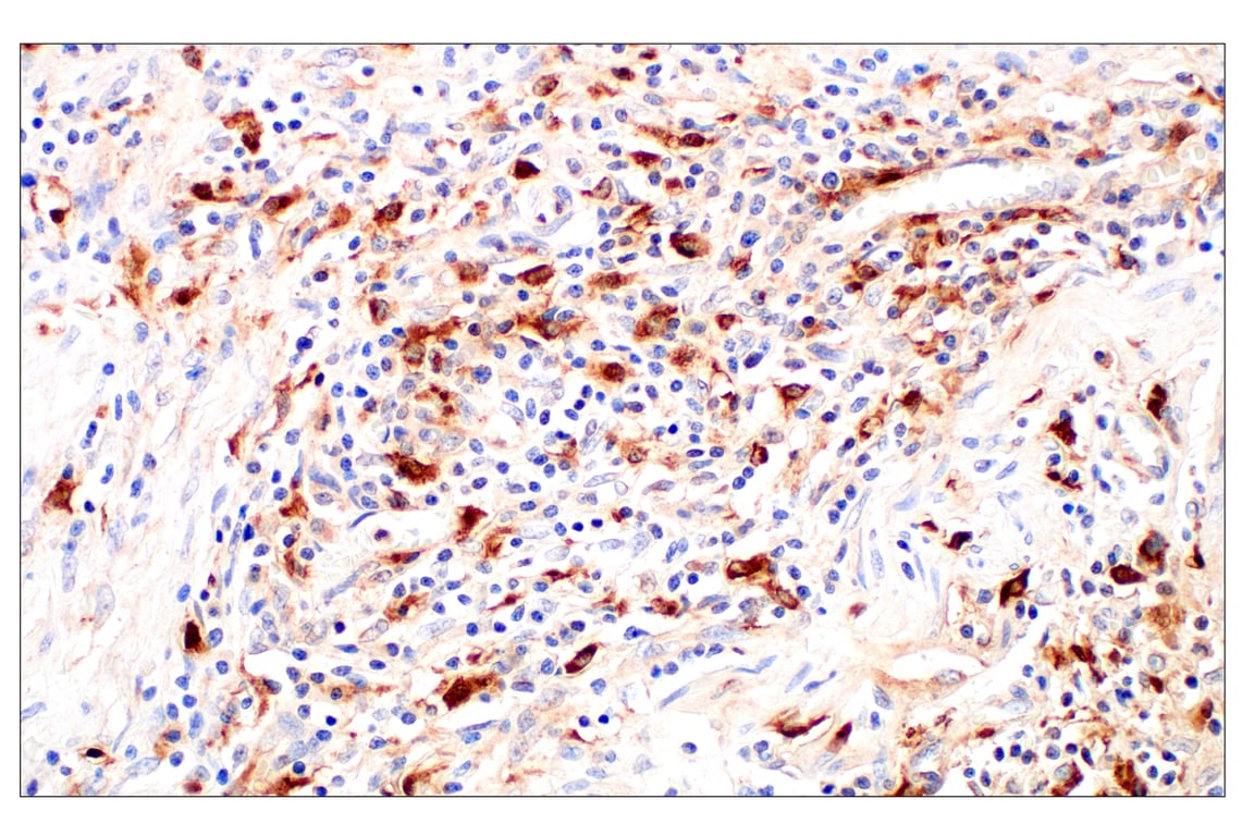 Immunohistochemistry Image 3: Cathepsin L (E3R3P) Rabbit Monoclonal Antibody (BSA and Azide Free)