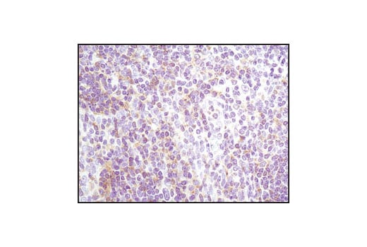 Immunohistochemistry Image 2: Lyn (C13F9) Rabbit Monoclonal Antibody (BSA and Azide Free)