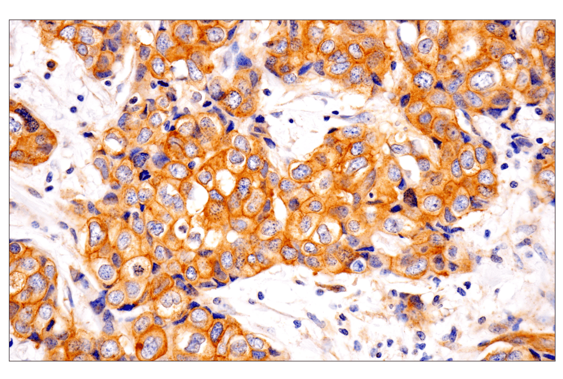 Immunohistochemistry Image 4: Numb (F2P3P) Rabbit Monoclonal Antibody