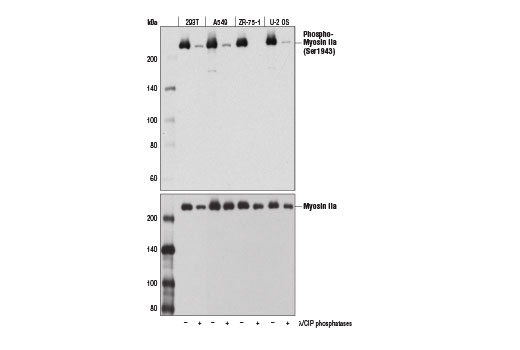 Western Blotting Image 1: Phospho-Myosin IIa (Ser1943) (D7Z7T) Rabbit mAb