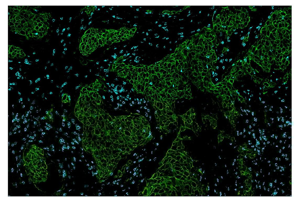 Immunohistochemistry Image 1: CD8 alpha (D8A8Y) & CO-0004-594 SignalStar<sup>™</sup> Oligo-Antibody Pair