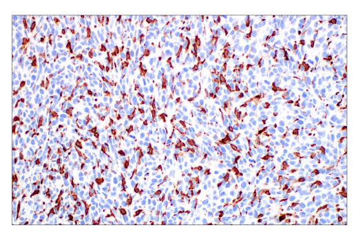 Immunohistochemistry Image 1: CD206/MRC1 (E6T5J) Rabbit Monoclonal Antibody (BSA and Azide Free)