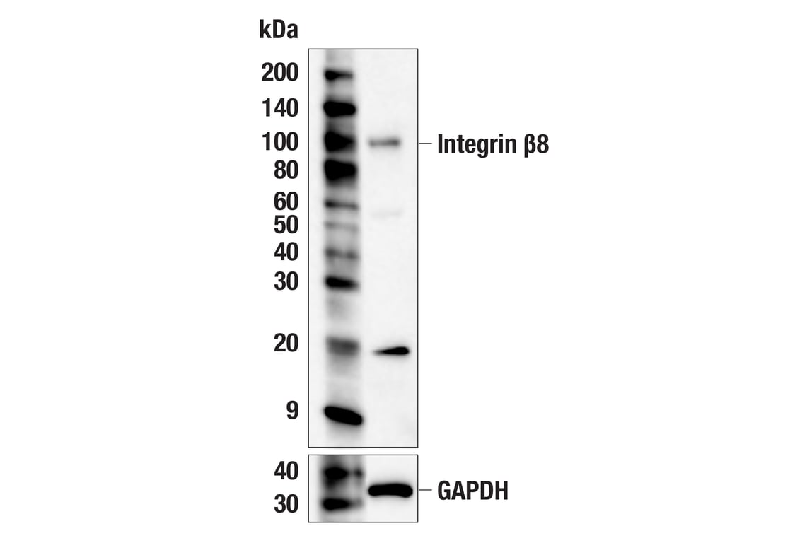 Western Blotting Image 2: Integrin beta8 (F1H4B) Rabbit Monoclonal Antibody