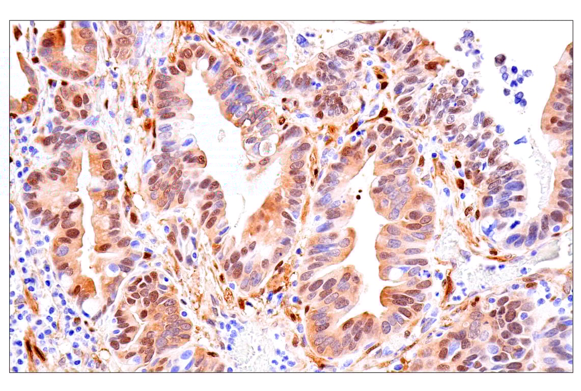 Immunohistochemistry Image 1: Phospho-YAP (Ser61) (E4Q8S) Rabbit Monoclonal Antibody