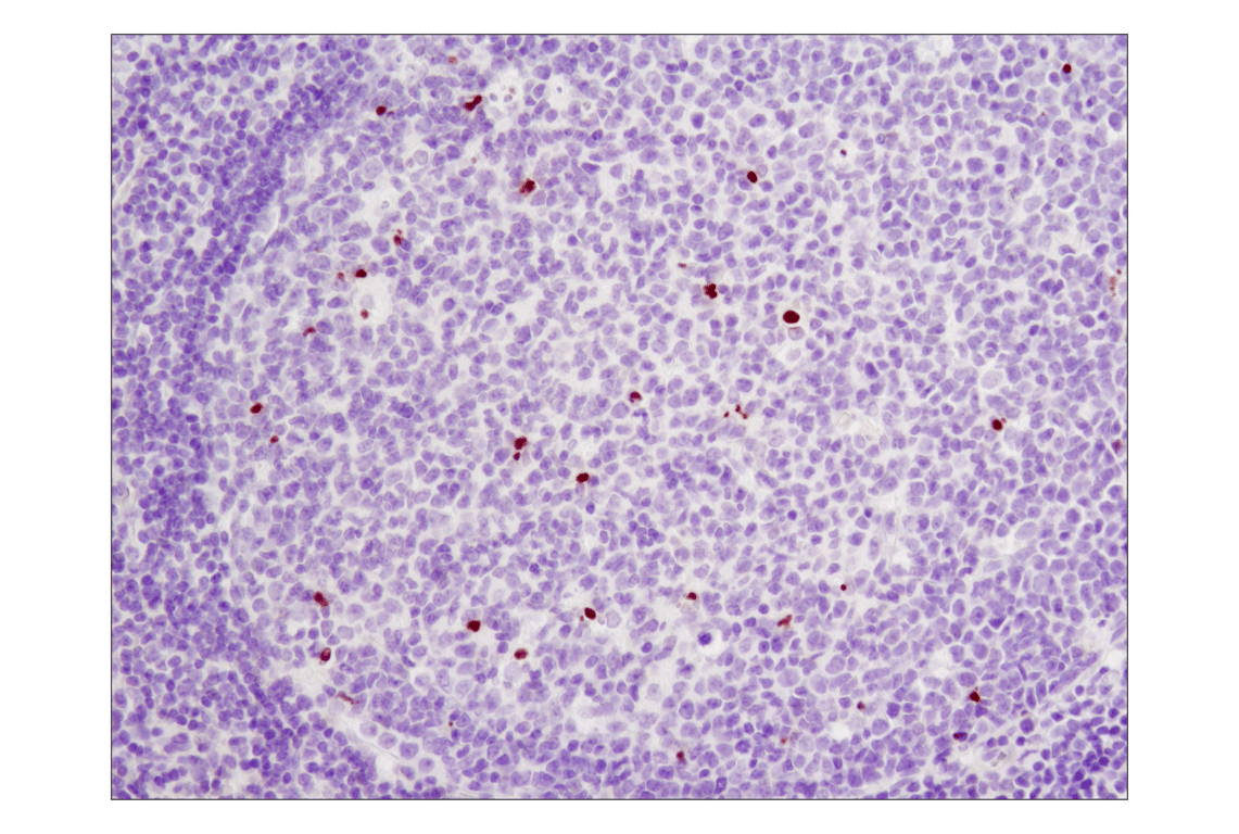 undefined Image 13: Human Reactive Cell Death and Autophagy Antibody Sampler Kit