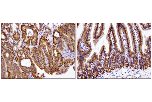 Immunohistochemistry Image 1: Non-phospho (Active) beta-Catenin (Ser33/37/Thr41) (D13A1) Rabbit Monoclonal Antibody (BSA and Azide Free)