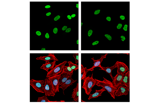 Immunofluorescence Image 1: RPA32/RPA2 (E8X5P) Rabbit Monoclonal Antibody